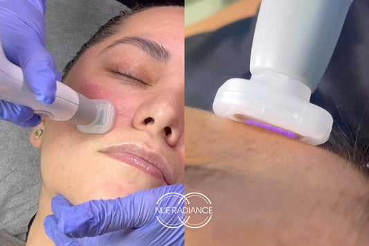 Full Facial (Jet Plasma+BioRepeel)